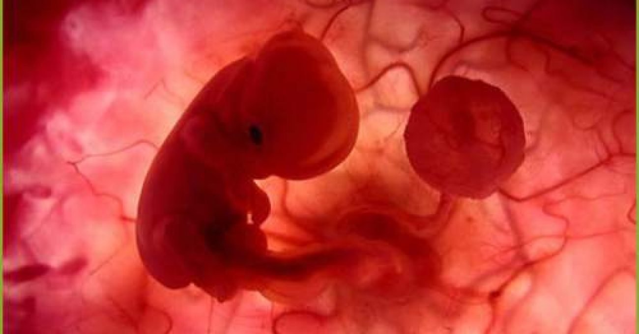 Aborto